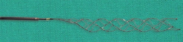 Stent_image