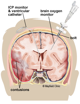 icp_monitor_image